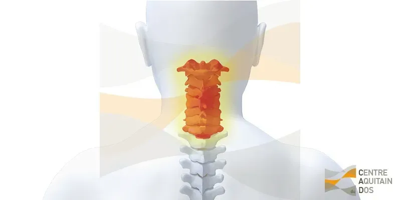 Cervicalgie