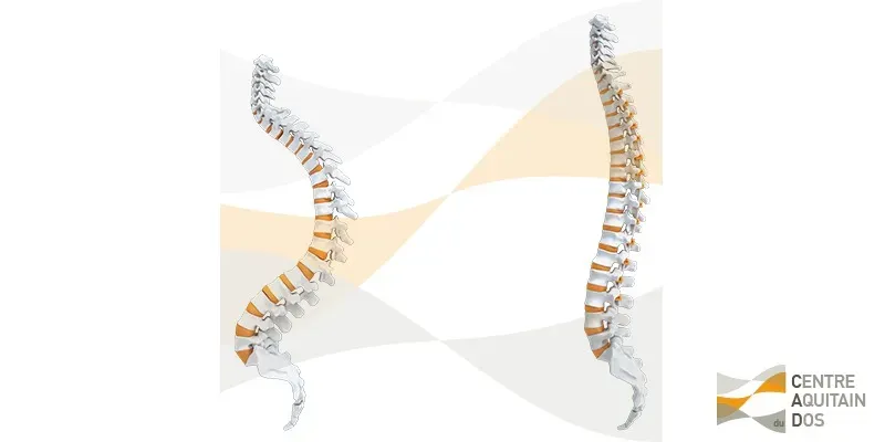 CAD_interventions_13_Correction_hypercyphose_thoracique_diff_synthes3d_v1_web_filigrane